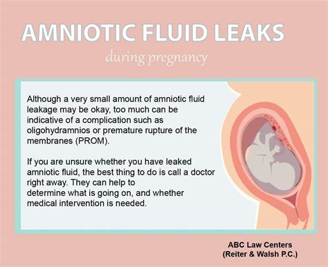 how do you know your leaking amniotic fluid|3 Ways to Identify an Amniotic Fluid Leak